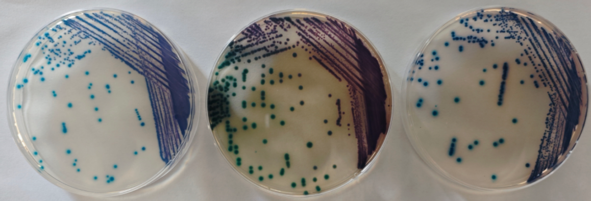 沙門檢測新助手—沙門氏+顯色培養(yǎng)基 沙門檢測新助手—沙門氏+顯色培養(yǎng)基