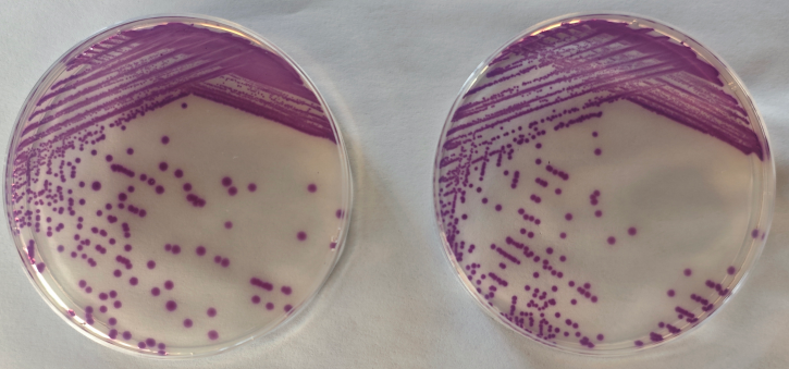 沙門檢測新助手—沙門氏+顯色培養(yǎng)基 沙門檢測新助手—沙門氏+顯色培養(yǎng)基