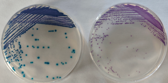 沙門檢測新助手—沙門氏+顯色培養(yǎng)基 沙門檢測新助手—沙門氏+顯色培養(yǎng)基
