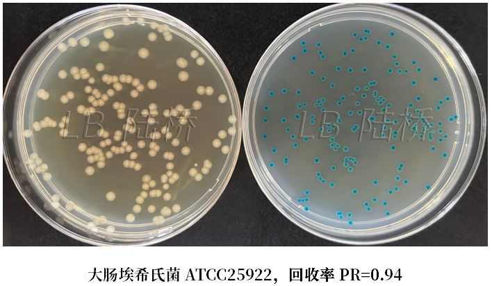 GB 4789.38-2025《食品安全國家標準 食品微生物學檢驗 大腸埃希氏菌計數(shù)》解讀 GB 4789.38-2025《食品安全國家標準 食品微生物學檢驗 大腸埃希氏菌計數(shù)》解讀