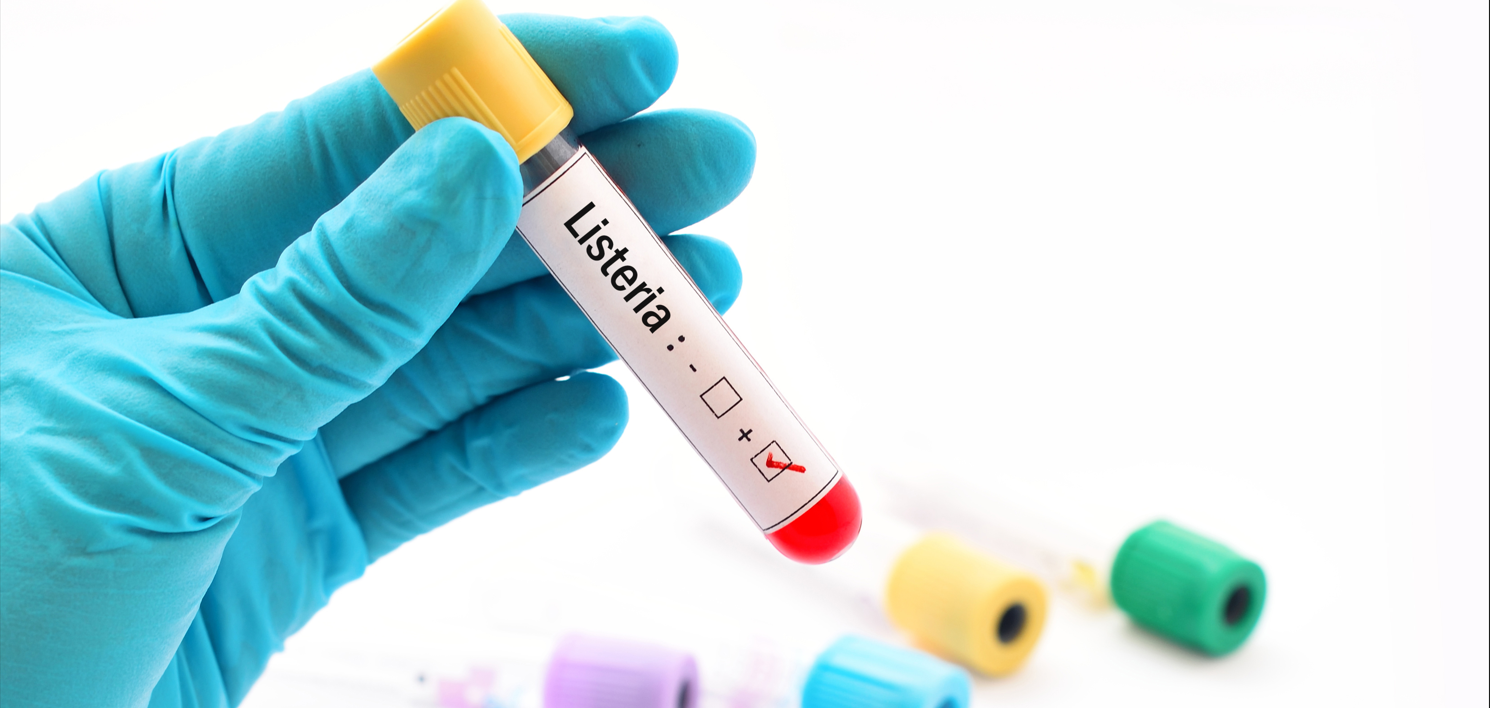 GB4789.30-2025單核細(xì)胞增生李斯特氏菌標(biāo)準(zhǔn)變化